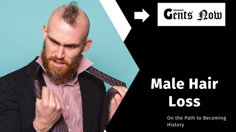 Male Hair Loss: On the Path to Becoming History